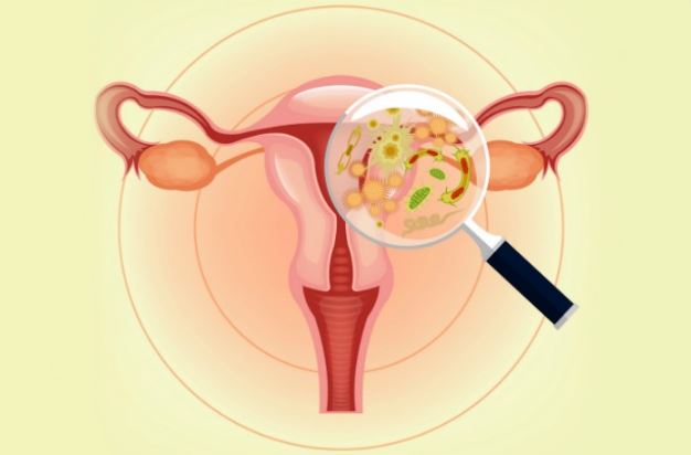 Bacterial Vaginosis Cause Symptoms Treatment Remedies
