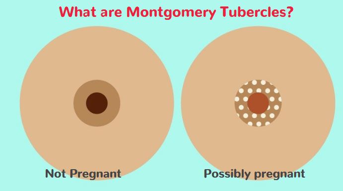What are montgomery tubercles
